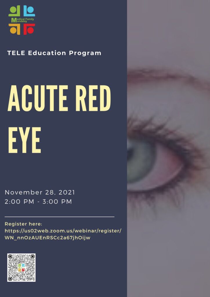 acute red eye